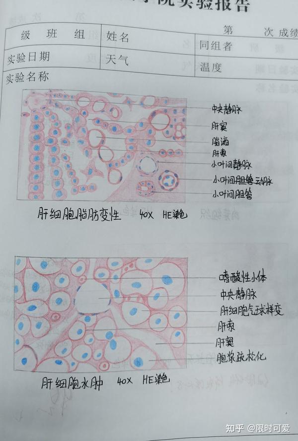 病理红蓝铅笔图