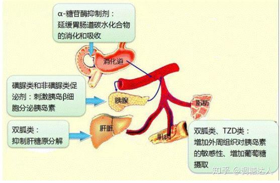 现在有很多类型的糖尿病药物,通常会联合用药.