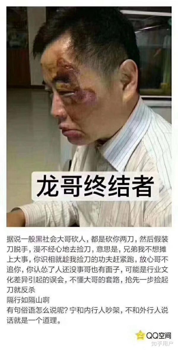 如何看待昆山震川路龙哥砍人被反杀事件?被砍男子行为算正当防卫吗?