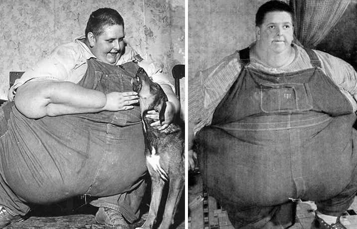 世界史上最胖的十大胖子,看完以后你还吃得下饭吗?