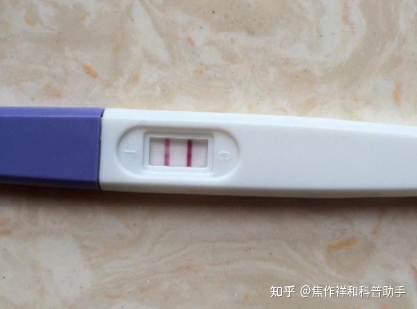 3 个多囊常见问题 看完不再焦虑 知乎