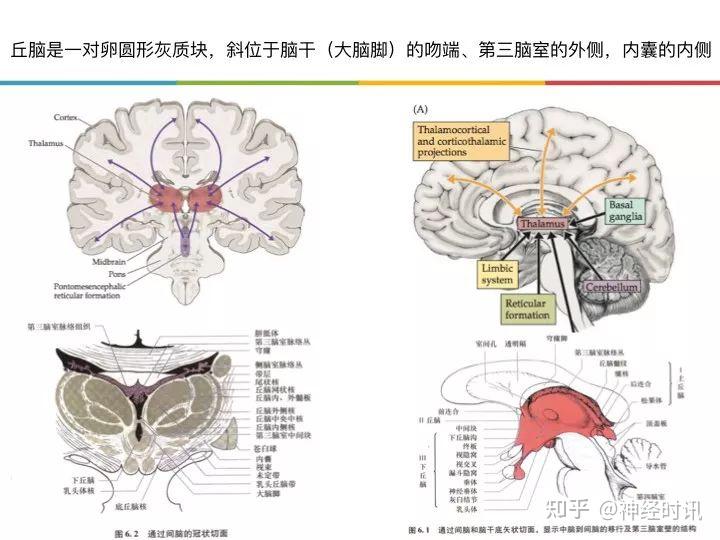 图解丘脑梗死的那些事儿 知乎