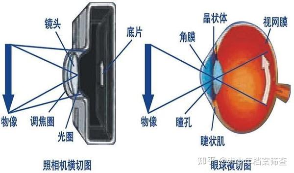 当前近视为什么不可逆,未来有可能让眼轴缩短吗?