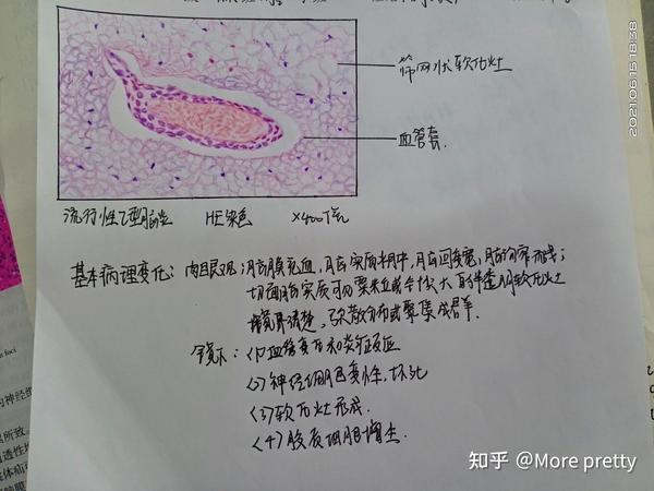 流行性乙型脑炎切片图