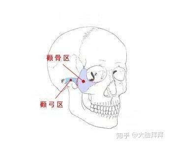 我颧骨很高,可以做削骨手术吗?有什么后遗症?