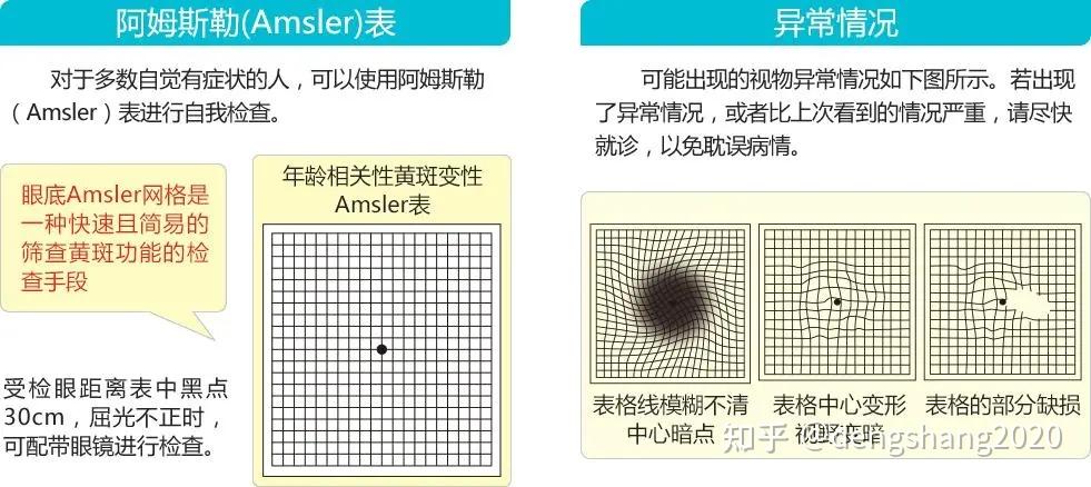 视力的好坏取决于视觉.