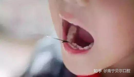 梦境解析，拔掉长出的两颗牙——探索内心成长的微妙变化