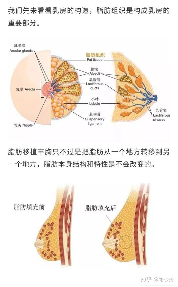 自体脂肪丰胸▏多余脂肪变废为宝安全变美
