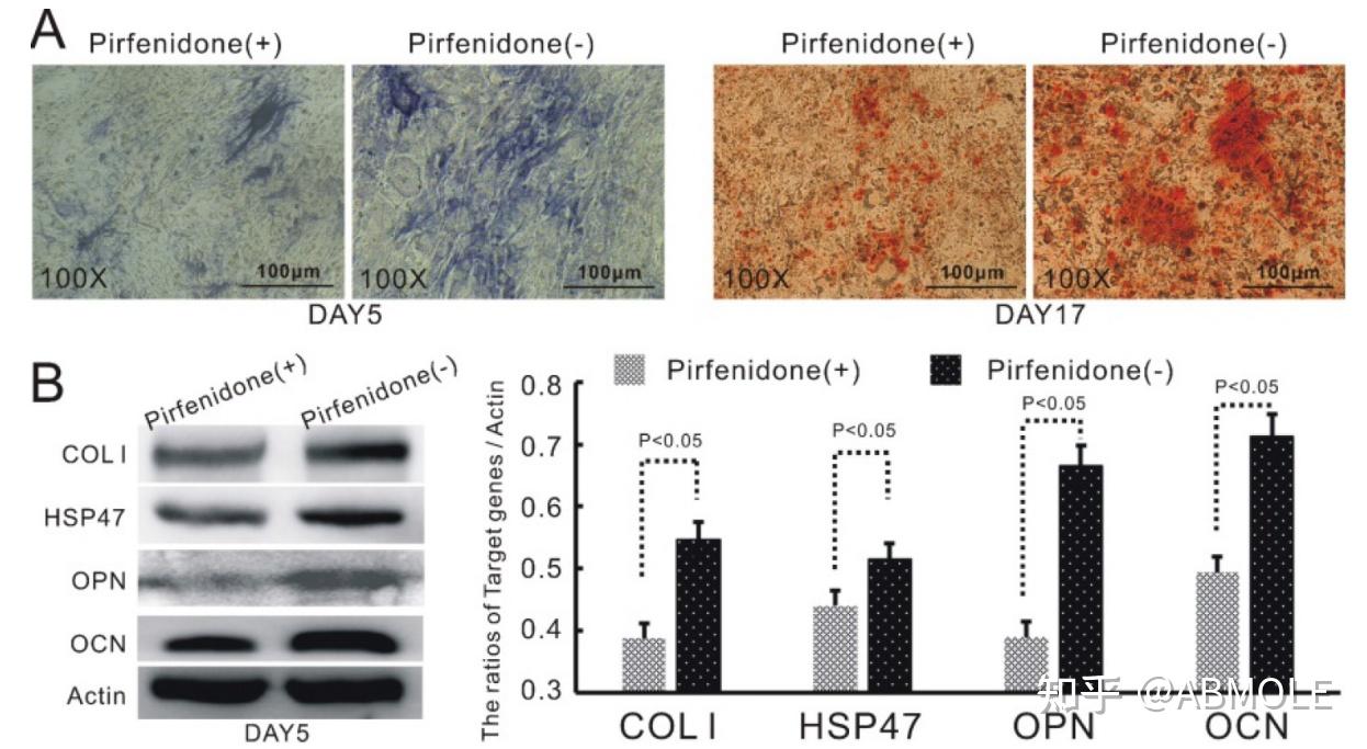 hsp47 mediates tgfβ1-dependent up-regulation of osteogenic