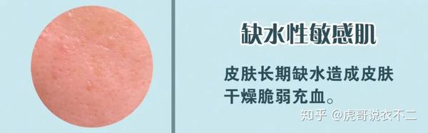 形成原因:由于皮肤长期缺水导致干燥,从而角质层变得脆弱,敏感.