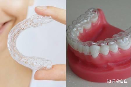 3, 传统和隐形牙套的区别: 周期:传统牙套矫正周期相对较短,需要1年