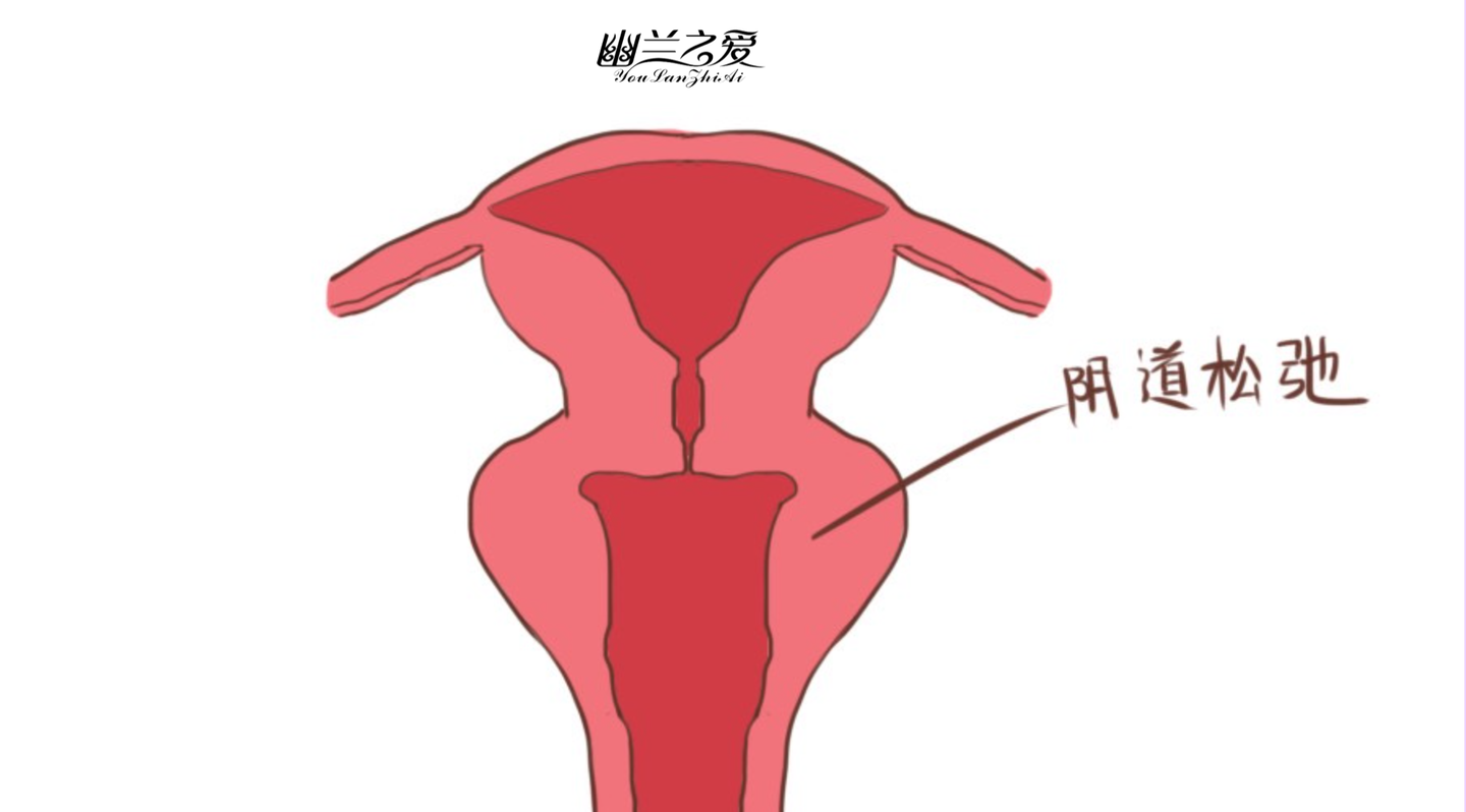 产后阴道松弛怎么办?产后松弛如何修复?幽兰之爱使用方法?