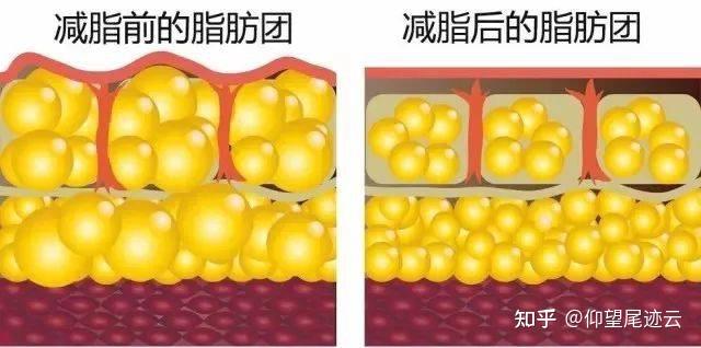 而减肥,就是把脂肪细胞里面这些甘油三酯利用掉一些,让脂肪细胞变干瘪
