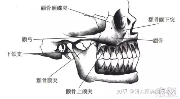 中面部有两个非常重要的支撑结构:颧骨体 颧韧带