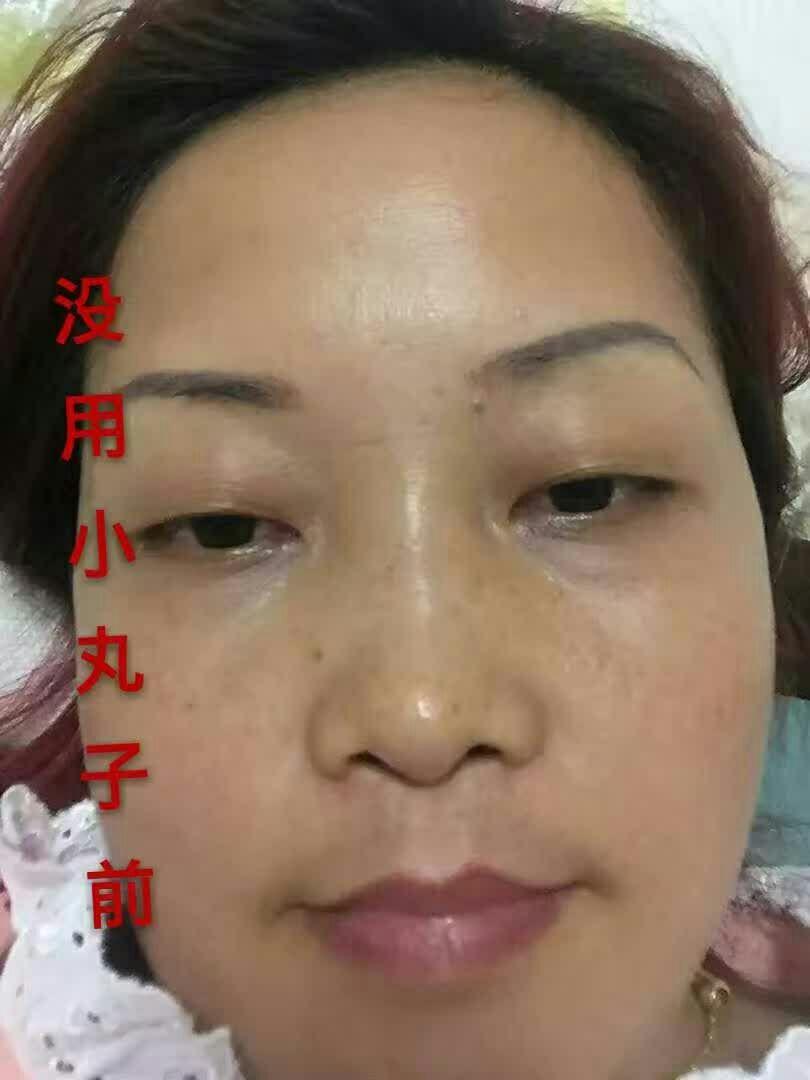 20岁女生油性肌肤,哪种补水面膜比较好?冰芝兰