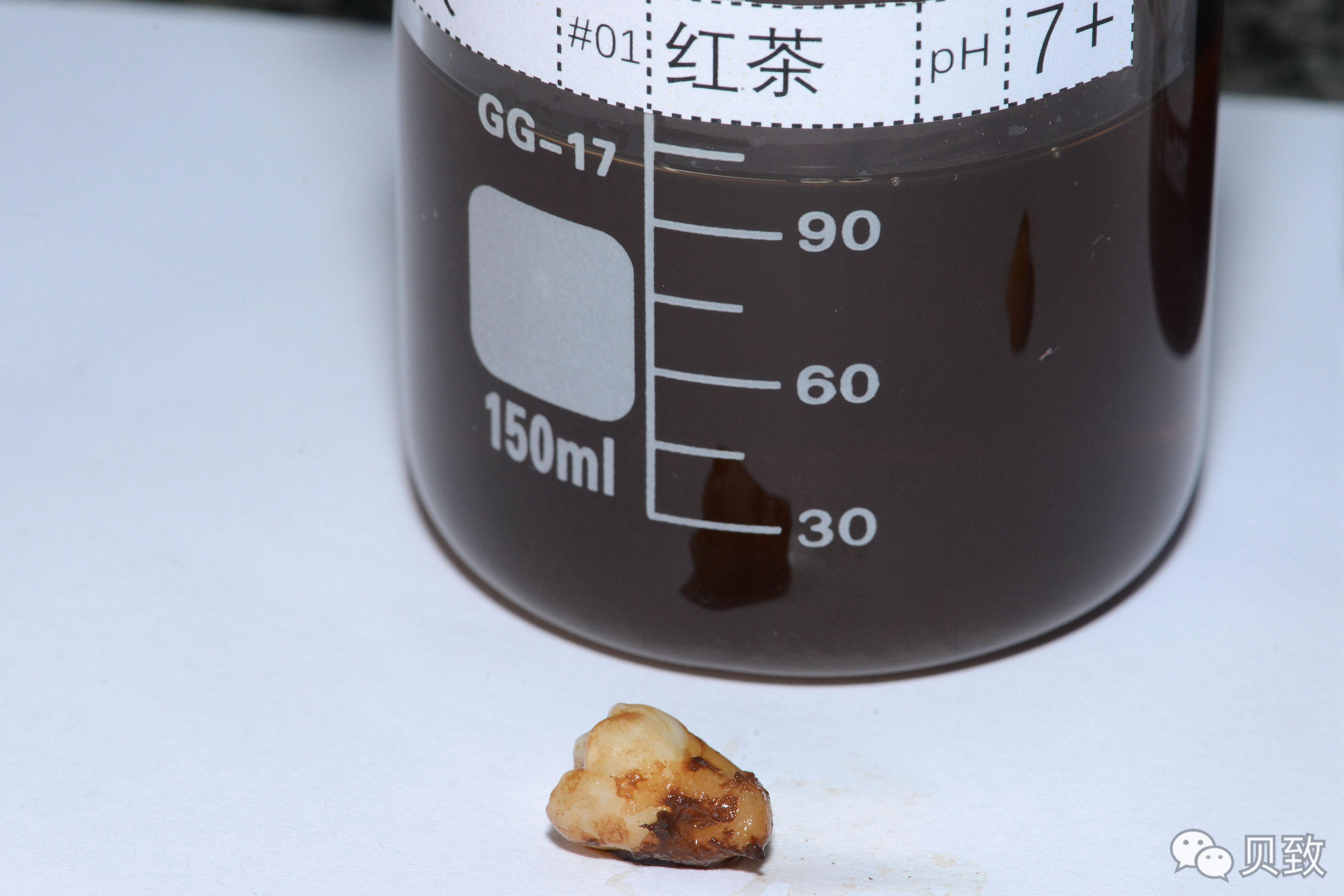 (转)谁能想到,饮料正在“谋杀”我们的牙齿 (转)谁能想到,饮料正在“谋杀”我们的牙齿