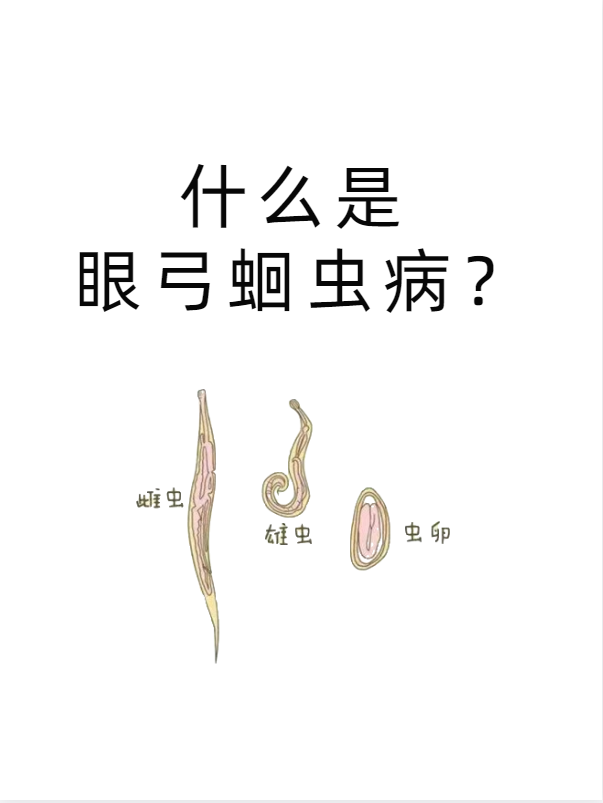 眼科朱成义医生 的想法: 什么是眼弓蛔虫病呢?