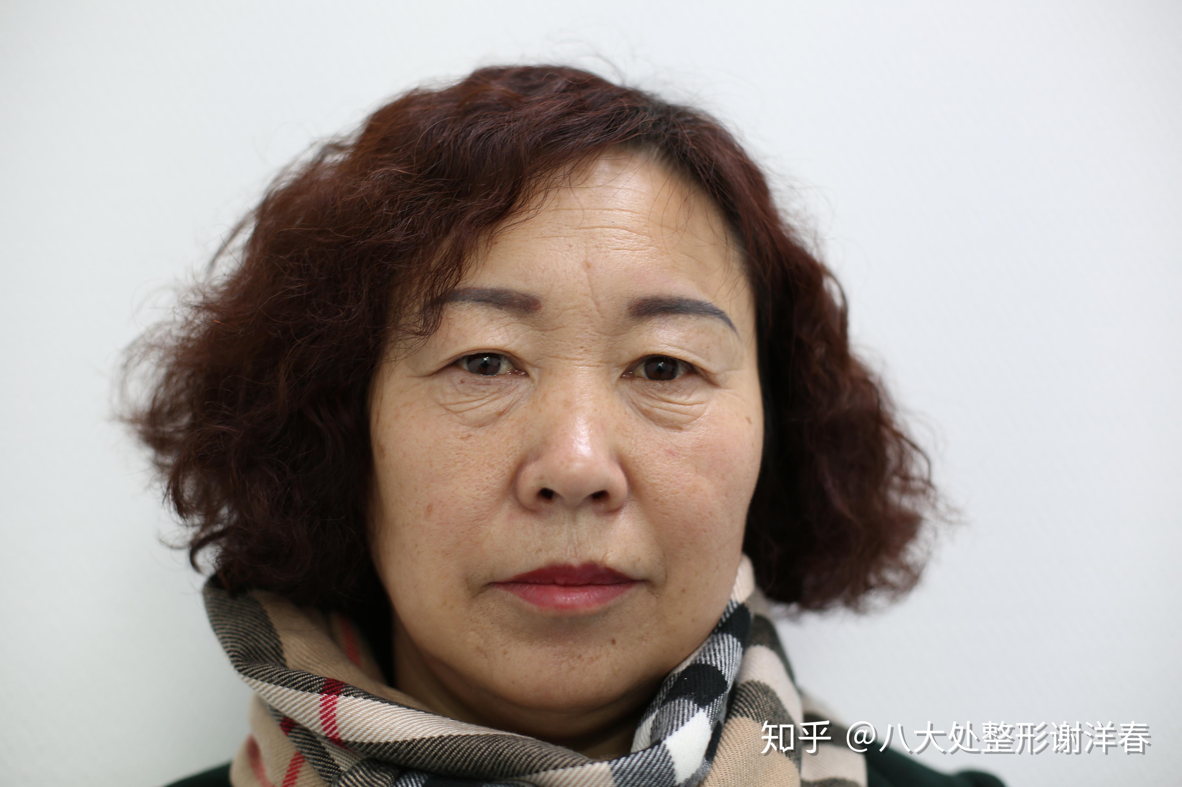 八大处整型医院地理位置黄牛号贩子代挂的简单介绍