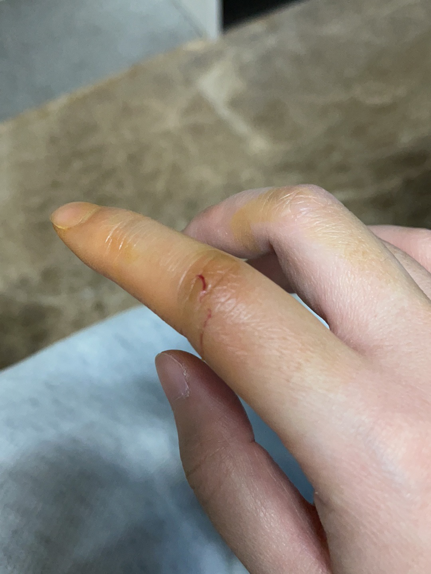 演员ya 的想法: 被实验大鼠咬后的一些记录