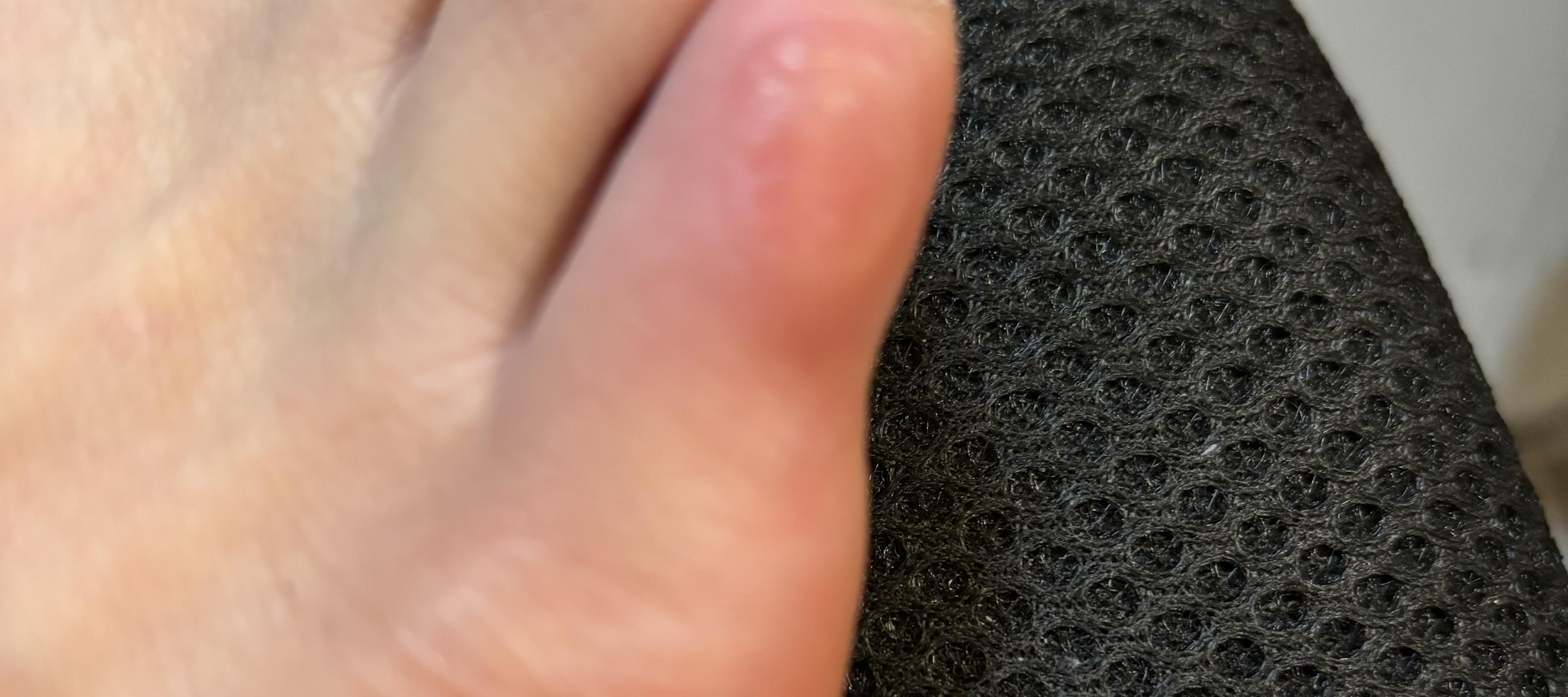 又来偷看我的动态 的想法: 就今天走的这几步路,右脚的小脚趾,磨起了