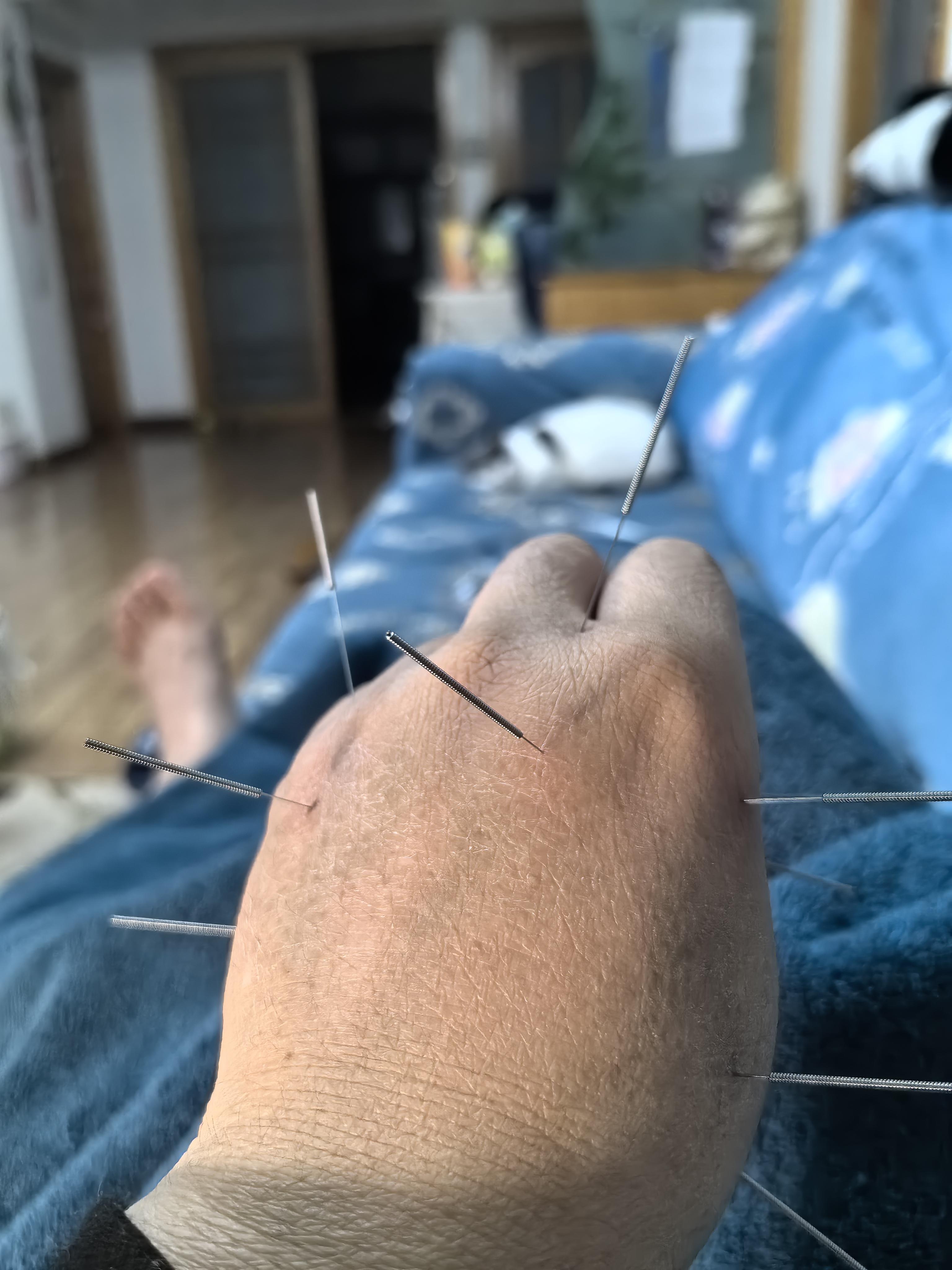 康百岁针灸推拿 的想法: 自我调理和大夫调理