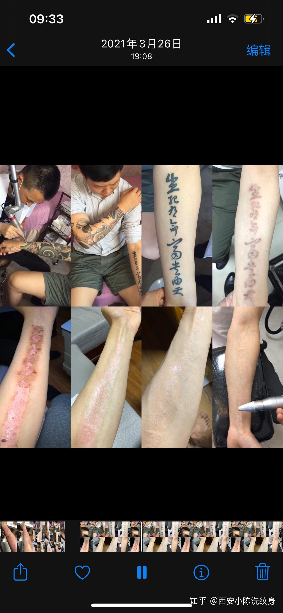 西安小陈洗纹身 - 知乎