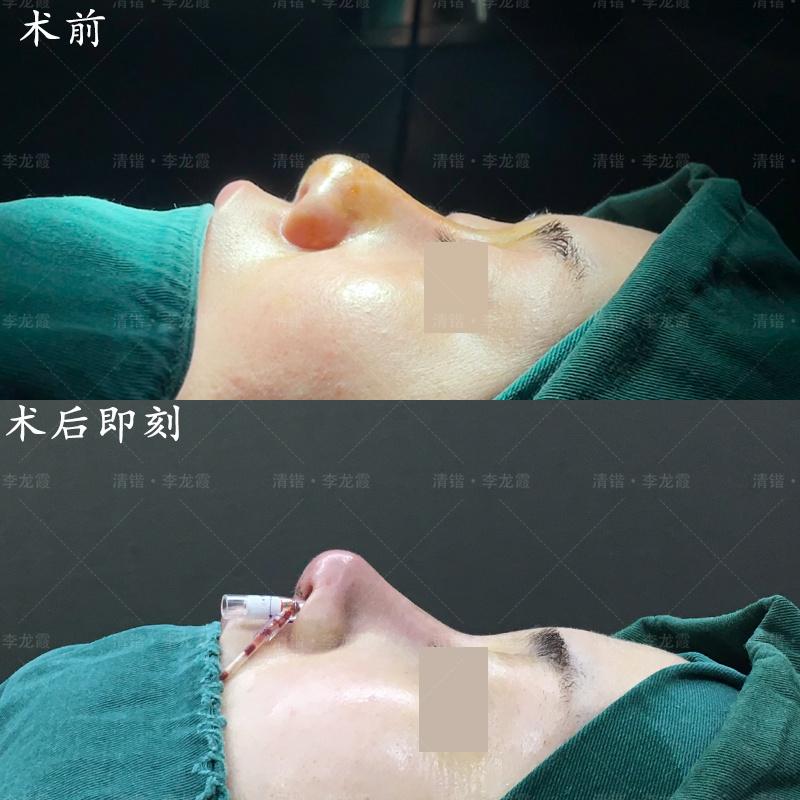 嘉兴隆鼻整形美容医院（嘉兴整形整容医院哪家好） 嘉茂盛
鼻整形美容医院（嘉兴整形整容医院哪家好）《嘉茂在哪里》 整形美容