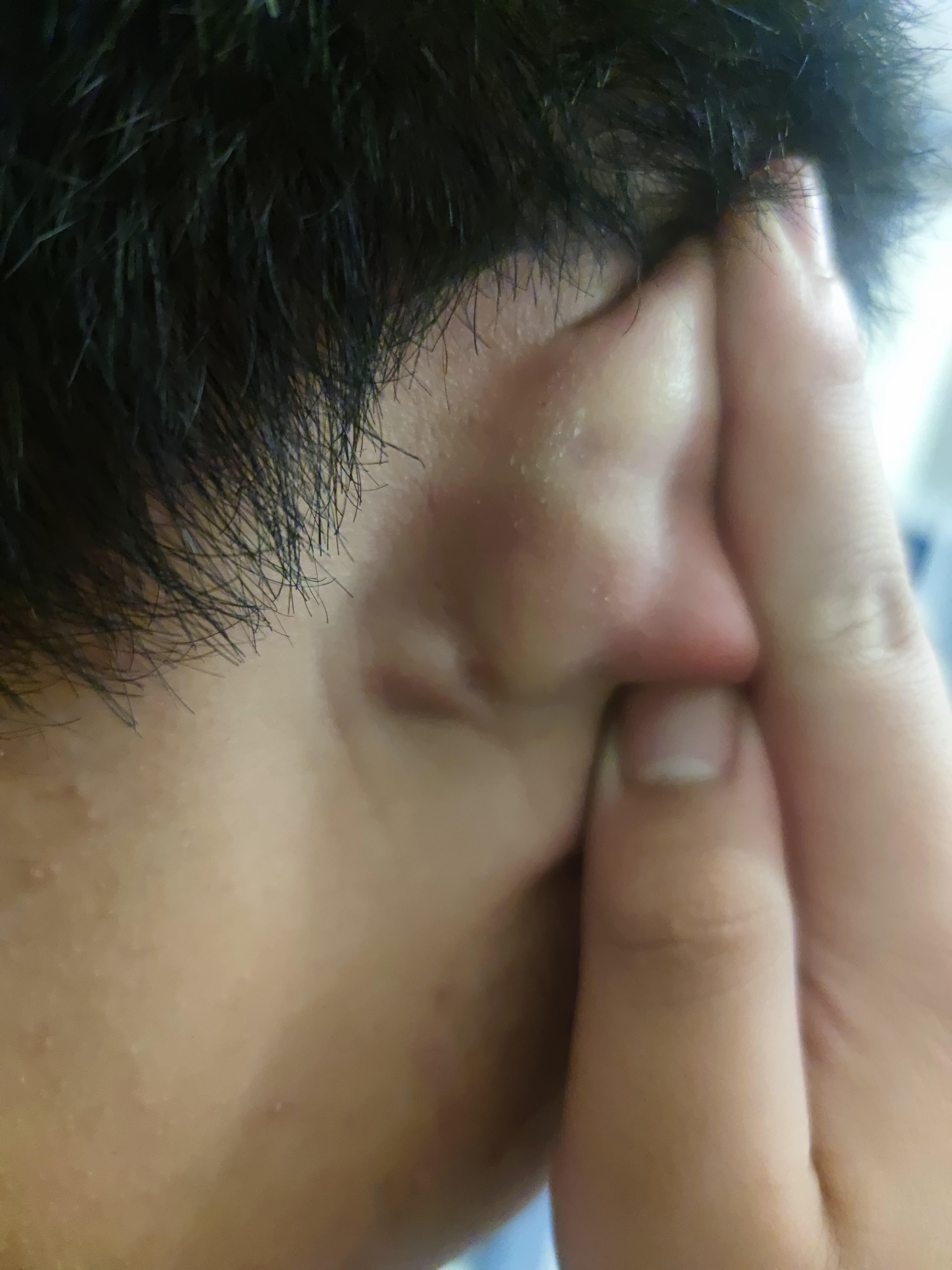 孩子耳朵后面长了个小硬块就这几个星期的事吧一按就疼这种情况要去