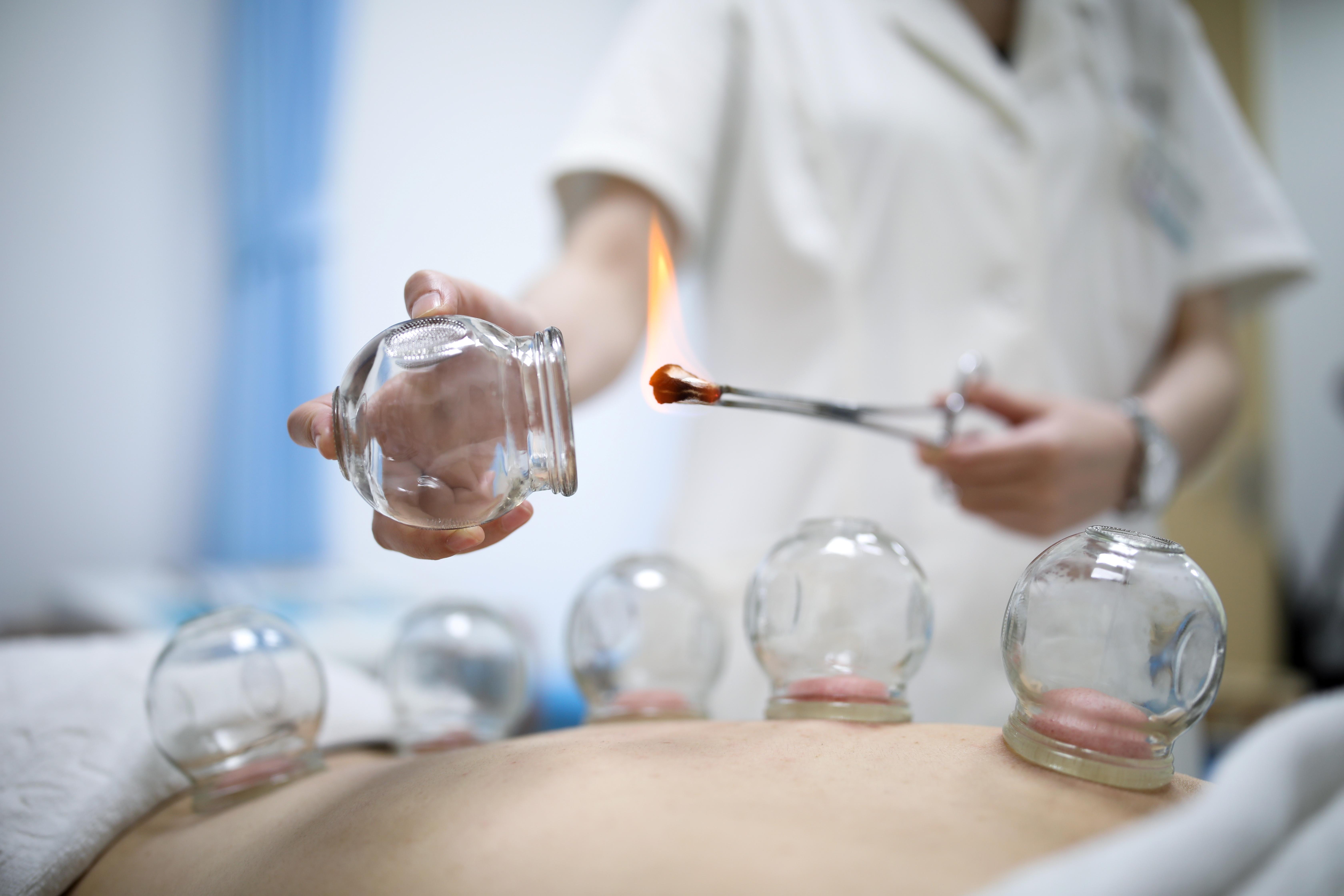 上海开元 的想法: 中医拔罐的适用人群有哪些?