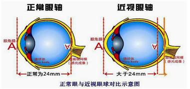 28c223bed9f4da2258c895221e826286_1440w.jpg?source=172ae18b