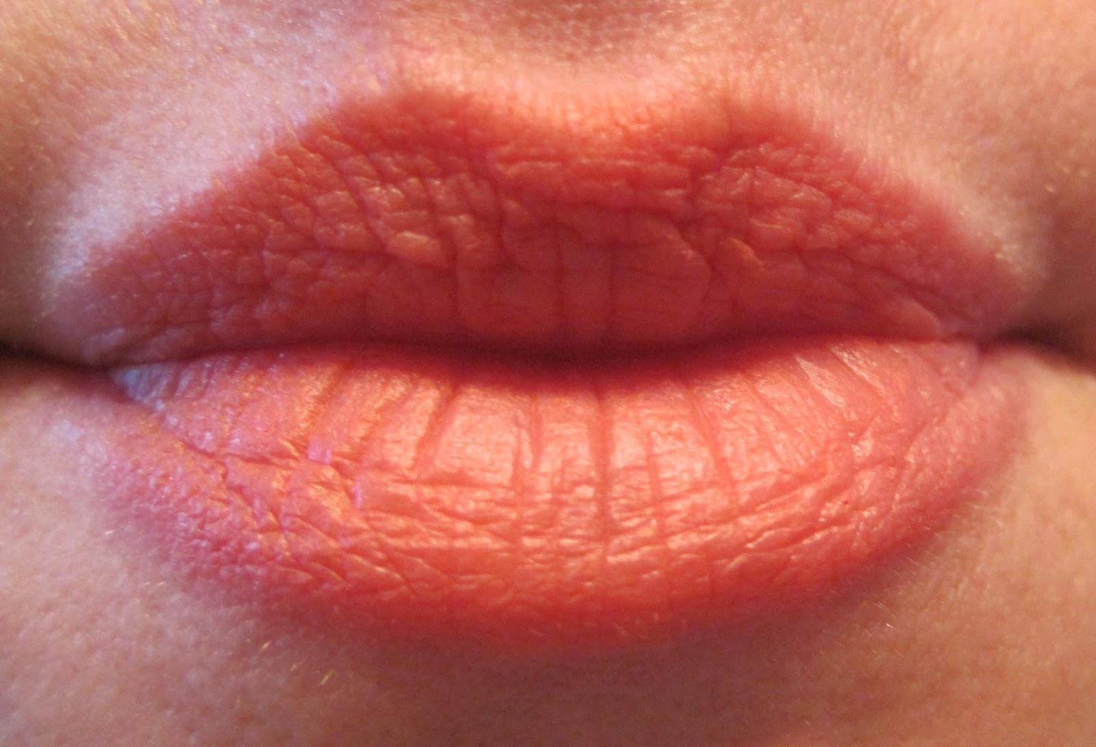 唇炎导致嘴唇发痒蜕皮，涂最滋润的唇釉都刺疼显唇纹，怎么才能快速改善啊？ - 知乎