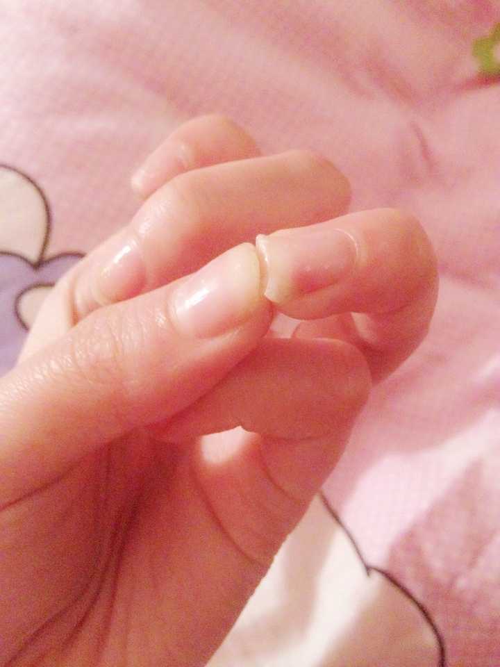指甲软是什么样的体验