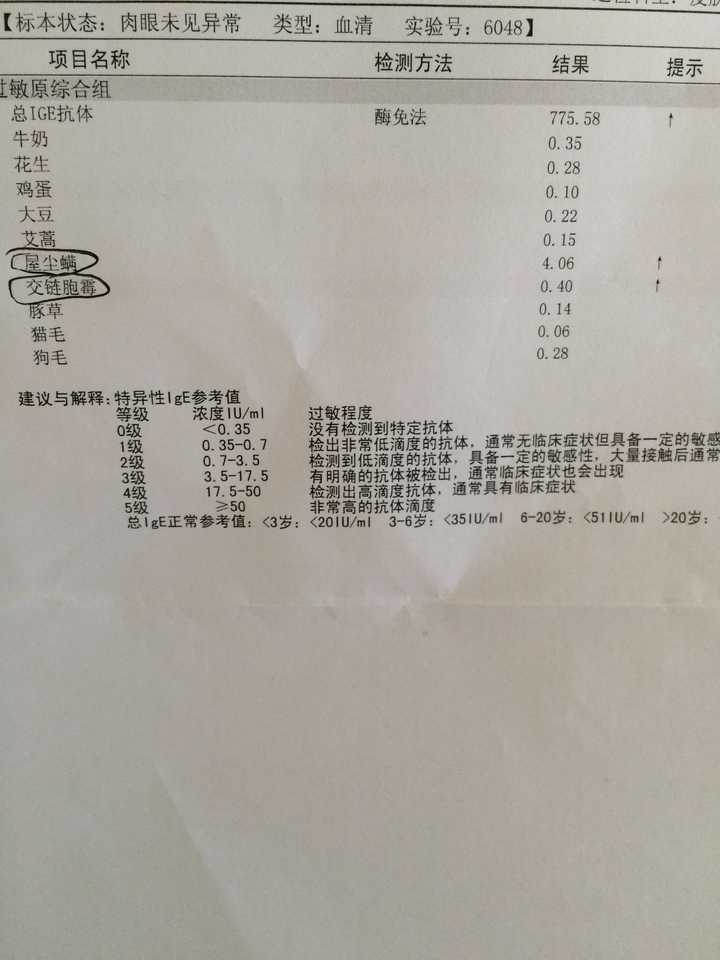 大家做过过敏原测试么 都有哪些 我可以带着我怀疑的过敏原去测试么 知乎 大家做过过敏原测试么 都有哪些 我可以带着我怀疑的过敏原去测试么 知乎