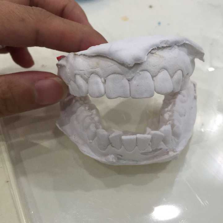 石膏模型就是这样师兄给我的建议是