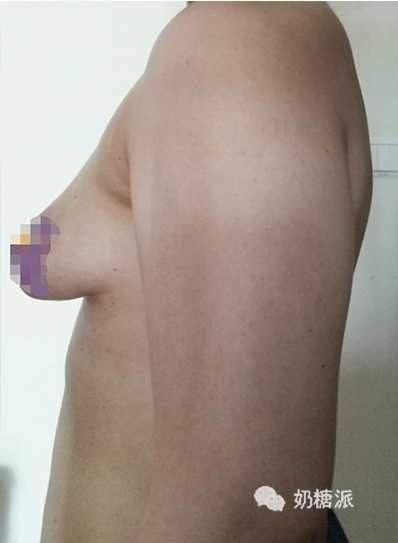 19岁女生有些胸下垂怎么才可以恢复 知乎