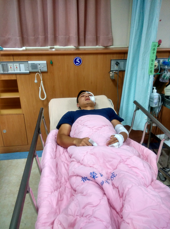 脑震荡是一种怎样的体验?