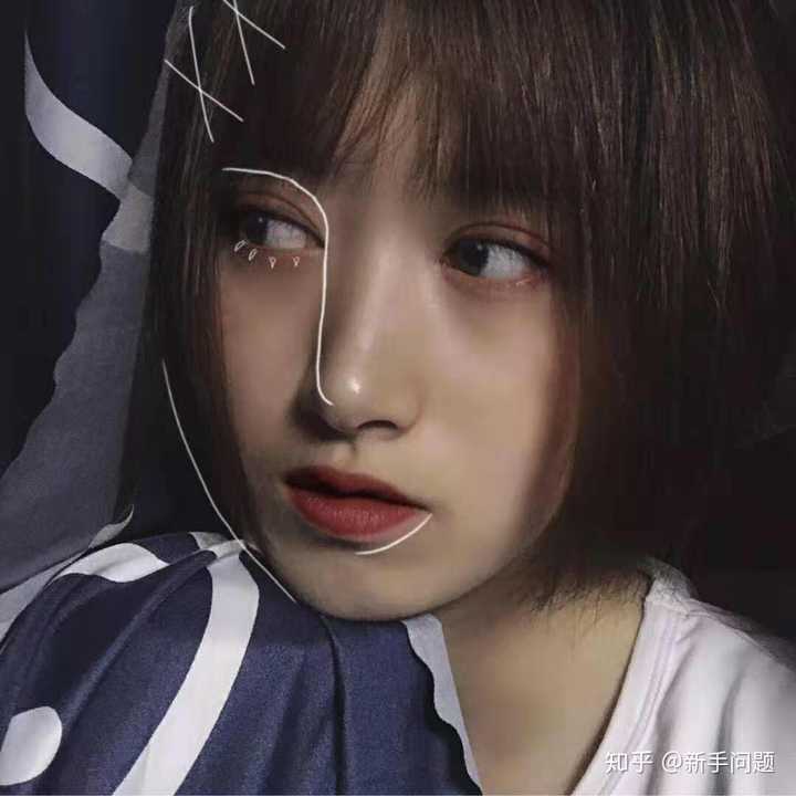 想知道有没有在福建省立医院丁力医生那里做过双眼皮的姐妹显示全部