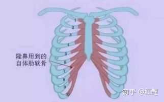 取肋骨做鼻子真的不疼吗 知乎