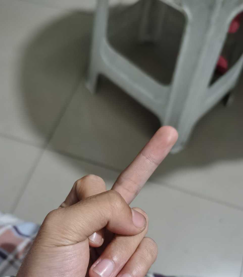 加菲猫 的想法: 测血糖的标准性手指 各位大爷大妈,我谢… - 知乎