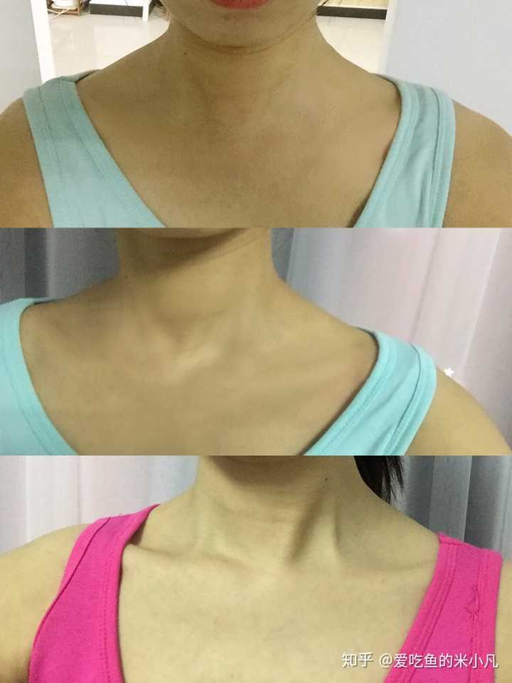 姐妹们,有什么方法快速练出明显锁骨(天鹅臂除外)?