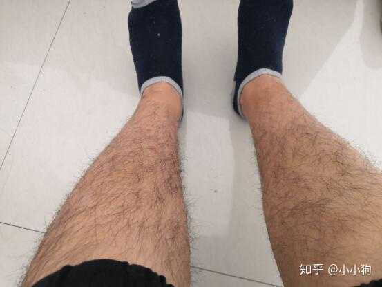 20多年了,以前从来没想过这问题,还以为腿毛重视男人的本性,是男人的