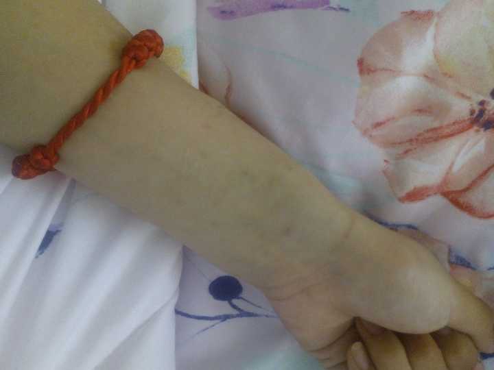 至少我再也不自残了,只是偶尔想不开,我还有关心我的人,伤口也都结痂