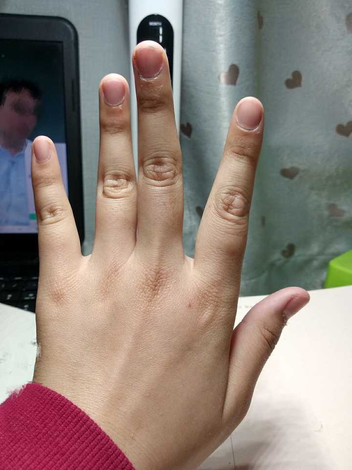 拥有一双不好看的手是种怎样的体验?