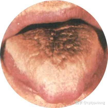 如何学好中医诊断学?