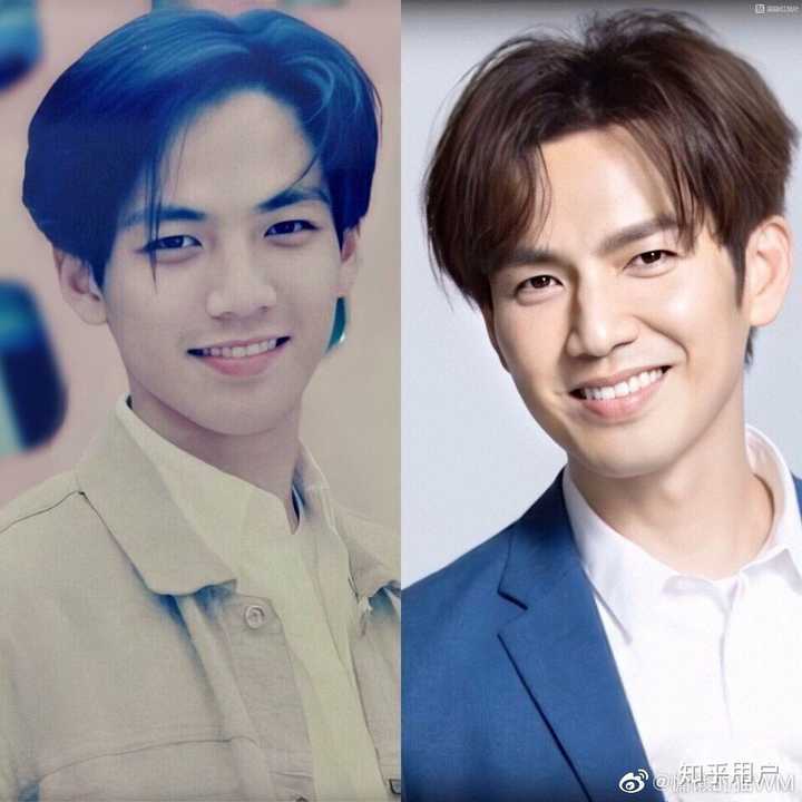 钟汉良做过哪些部位的整形 知乎 钟汉良做过哪些部位的整形 知乎