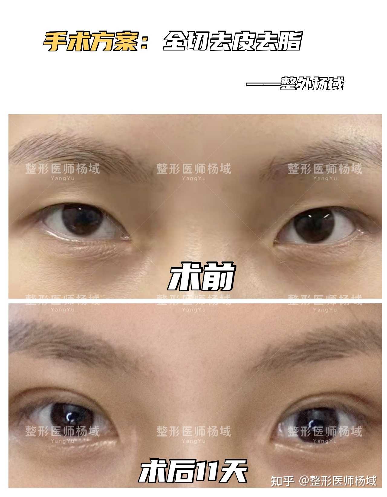 案例分享