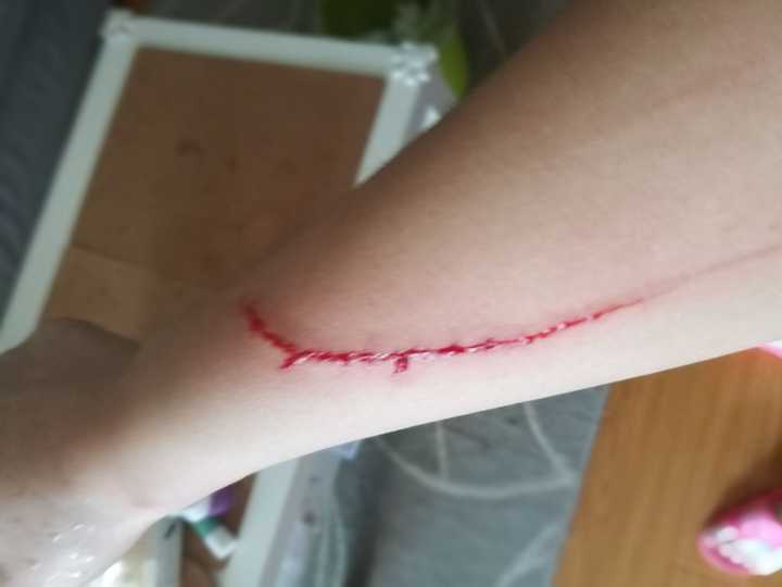 你被猫抓得最惨的一次到什么程度?