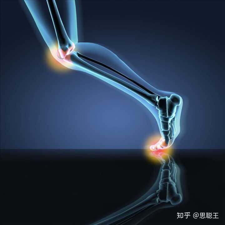 跑步时,脚一落地膝盖就疼,上下楼梯也疼!