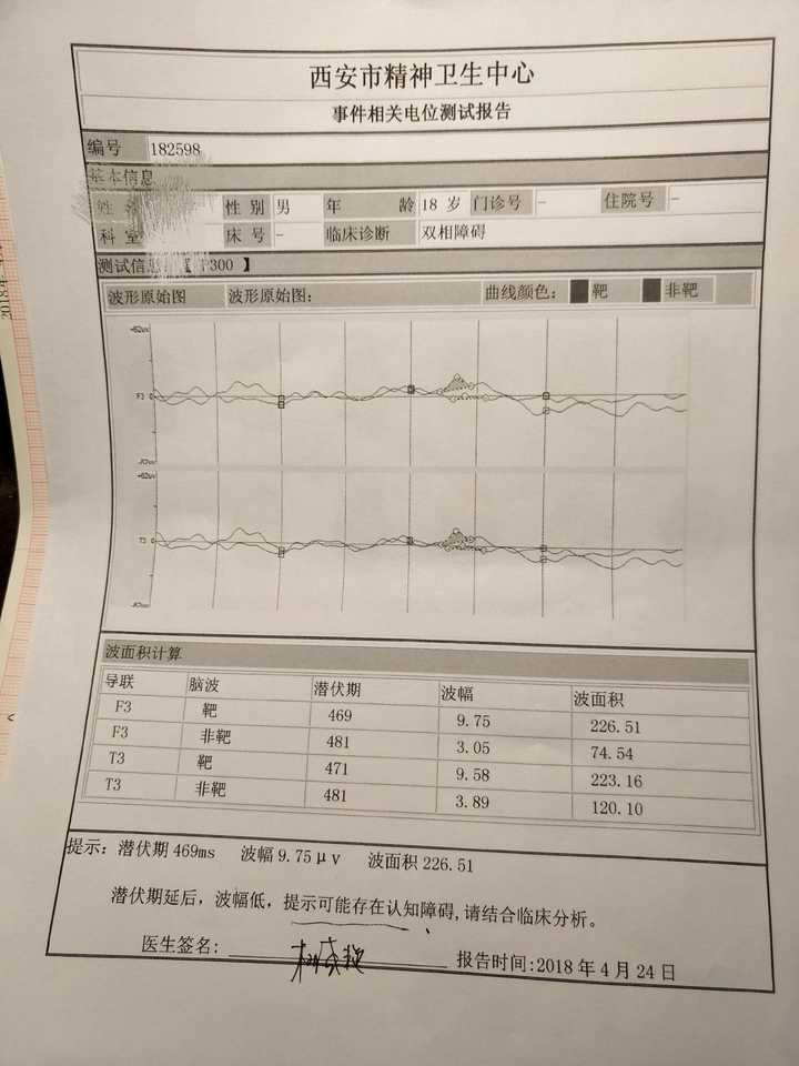 正常人有没有办法伪装成精神病 并且被成功确诊 知乎