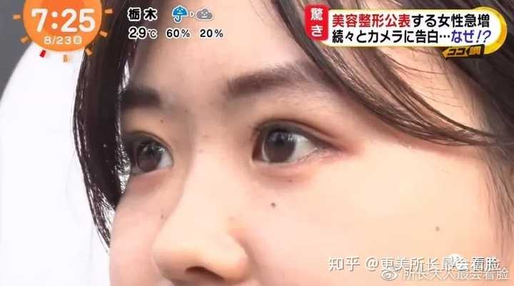 如何去日本整容 知乎